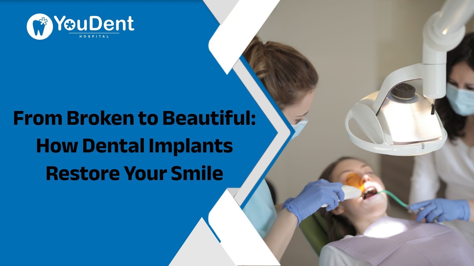 Dental Implants Restore Your Smile