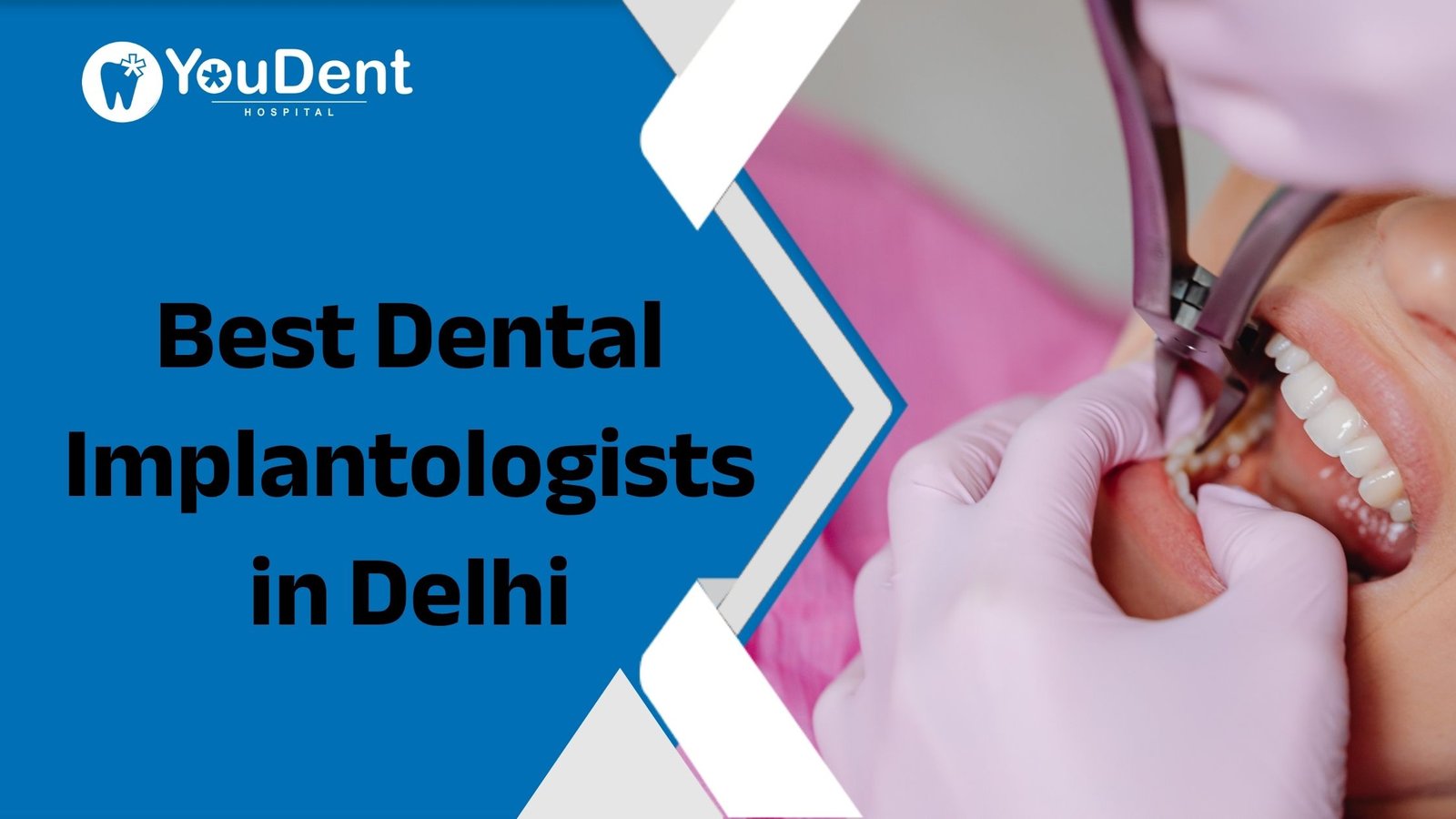Best Dental Implantologists in Delhi